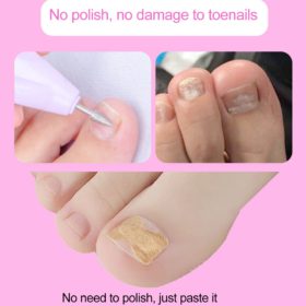 Glue Free Toenail Patch