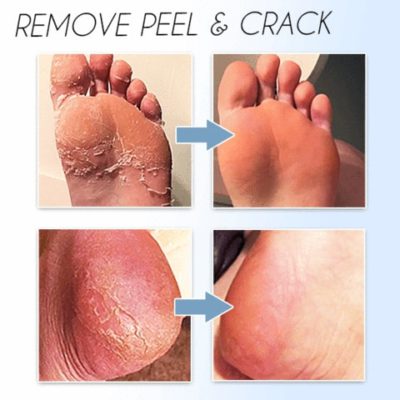 Premium Foot Peel Mask(2PCS)