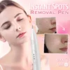 Removal Pen,Spot Removal,Spot,Removal,Pen