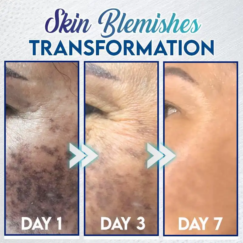 Instant Blemish Removal Gel - Image 2