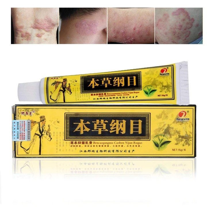 Advanced Psoriasis & Eczema Natural Herbal Cream - Molooco Shop