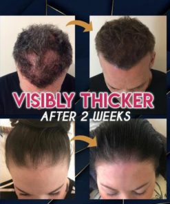 Pure Grow Hair Growth Essence