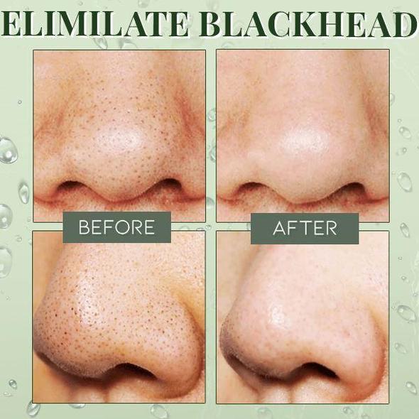 Farims Blackhead Dissolving Gel - Image 2