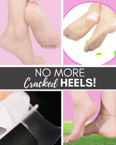 InvisiHeel Anti-cracking Protection Film