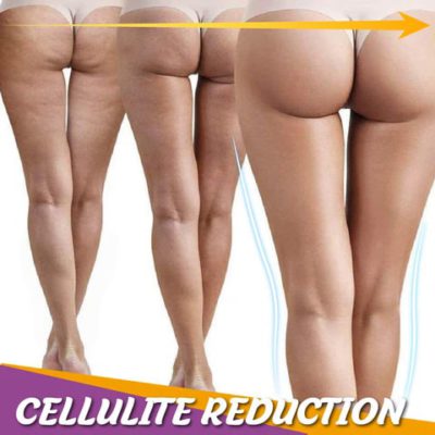 Tridal Fat Loss 3D Massager