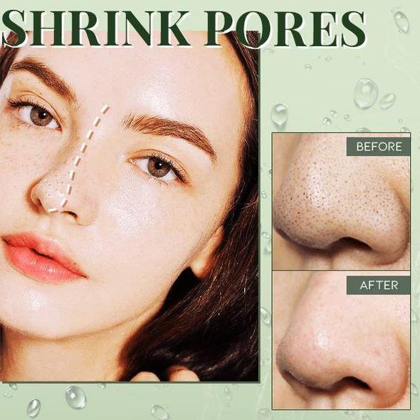 Farims Blackhead Dissolving Gel - Image 3