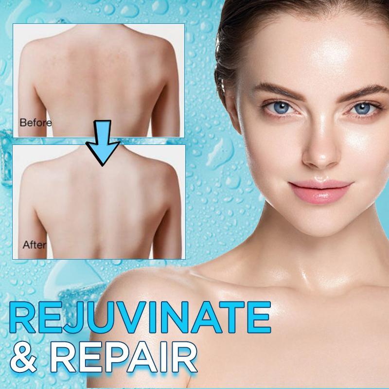 IceCream Cooling Body Mask - Image 2