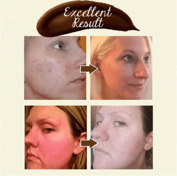 Herbal Refining Peel-Off Mask - Image 5