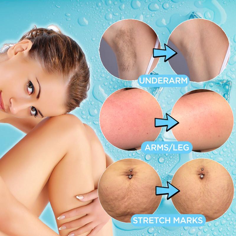 IceCream Cooling Body Mask - Image 4