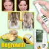 GingerGrowth Anti-Hair Loss Spray