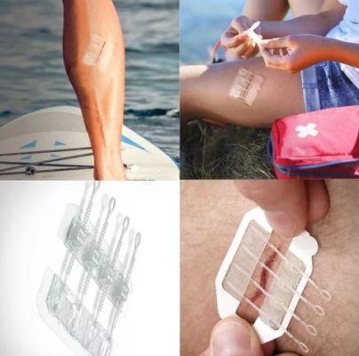 Needle-Free Tightening Suture Wound Band-Aid