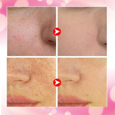 Porc Free Tightening Serum