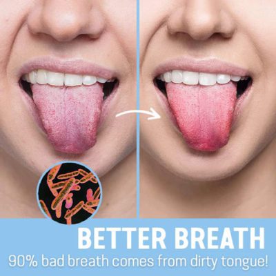 Breath Rescue Tongue Scrapper