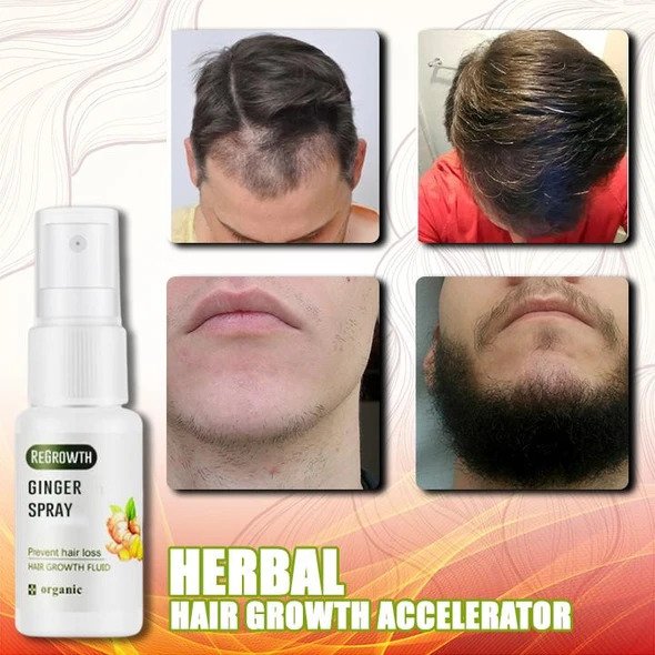 GingerGrowth Anti-Hair Loss Spray - Image 4