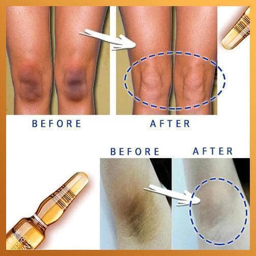 Instant Dark Spot Lifting Ampoule - Image 4