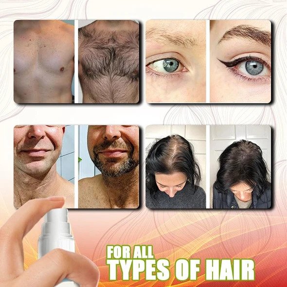 GingerGrowth Anti-Hair Loss Spray - Image 8