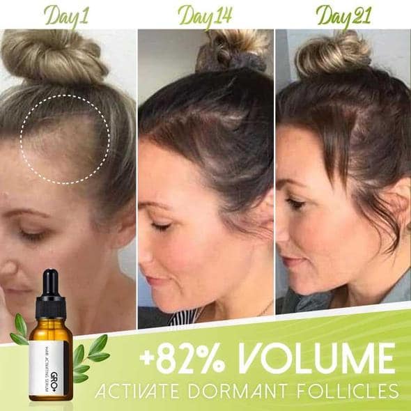 Gro+ Hair Activating Serum - Image 2