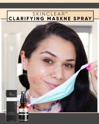 SkinClear Clarifying Maskne Spray