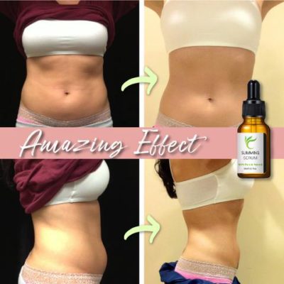Tummy Tuck Belt with Fat Burn Serum