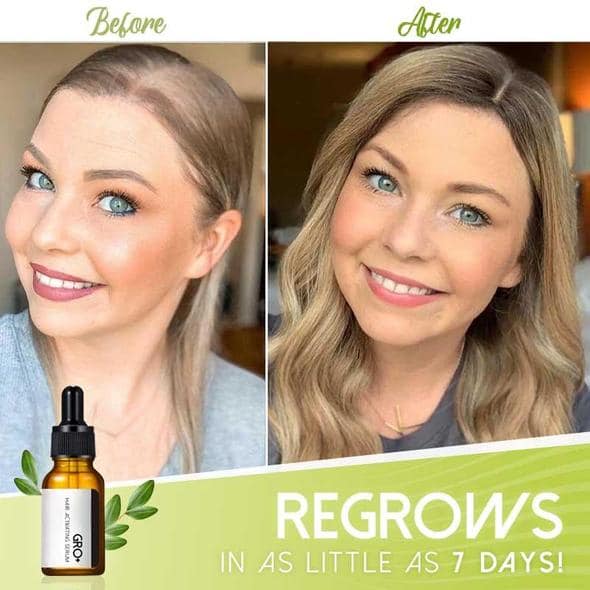 Gro+ Hair Activating Serum - Image 3