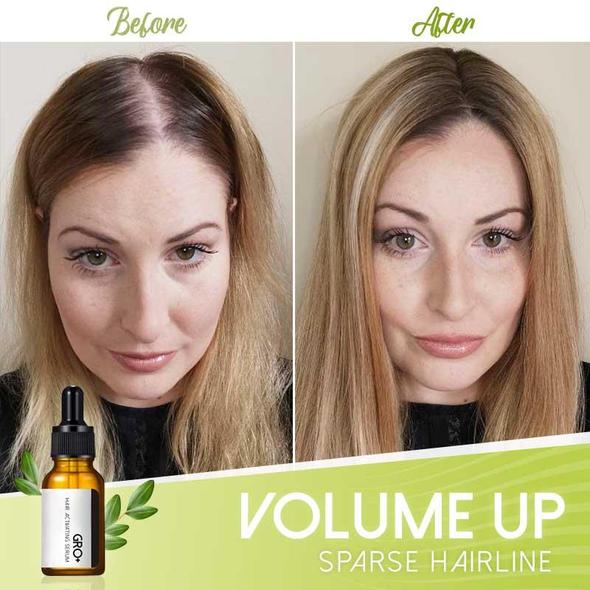 Gro+ Hair Activating Serum - Image 4