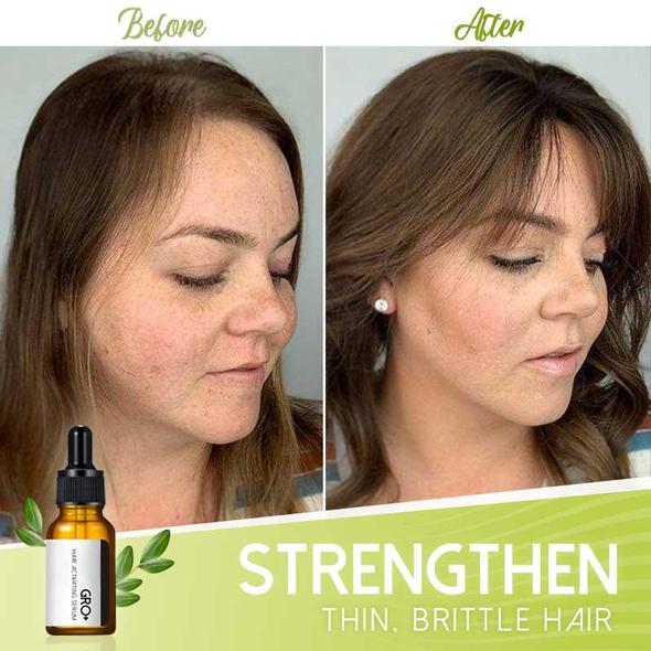 Gro+ Hair Activating Serum - Image 5