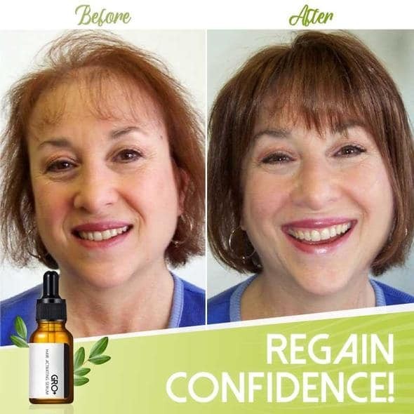 Gro+ Hair Activating Serum - Image 6
