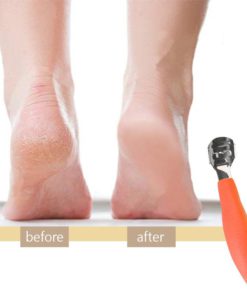 CallusRemedy Foot Tool