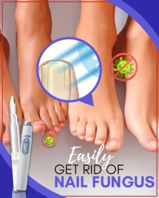 Fungal-out Blue Light Treatment Set,anti fungal nail treatment,best anti fungal nail treatment,strong anti fungal nail treatment,all natural anti fungal treatment