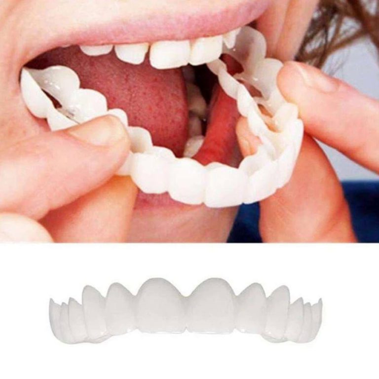Magic Teeth Brace reviews Not sold in stores MOLOOCO
