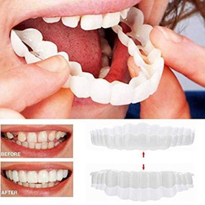 Magic Teeth Brace,magic teeth,magic teeth braces,magic smile teeth brace,best clip on veneers