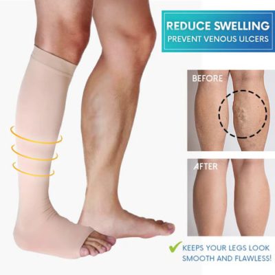 Circulation Boost Socks,compression stockings,blood clots,blood flow,thigh-high