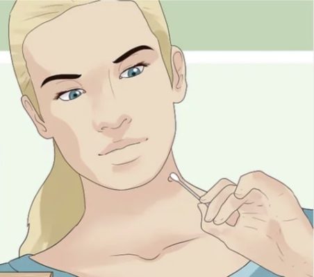 OFFImperfections Upgraded Skin Tag Removal,Skin Tag Removal,how to remove skin tags,get rid of skin tags,how to get rid of skin tags