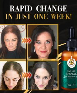 DR.Gro Anti-Hairloss Serum