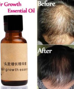 Organic Hair Growth Essence