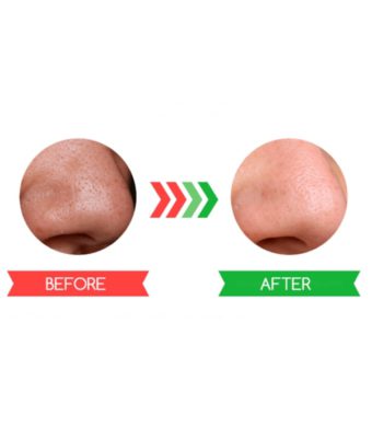 ការបំបាត់មុនក្បាលខ្មៅរបាំងមុខគួរឱ្យស្ញប់ស្ញែងឈុតម៉ាស់ខ្មៅរបាំងខ្មៅ - លាបម៉ាសបិទ