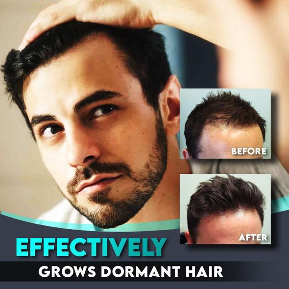 Hair Regrowth Roller & Essence Set - Image 2