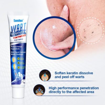 Wart Remover Cream,mole removal cream,Blemish Removal Cream,Instant Blemish Removal Cream
