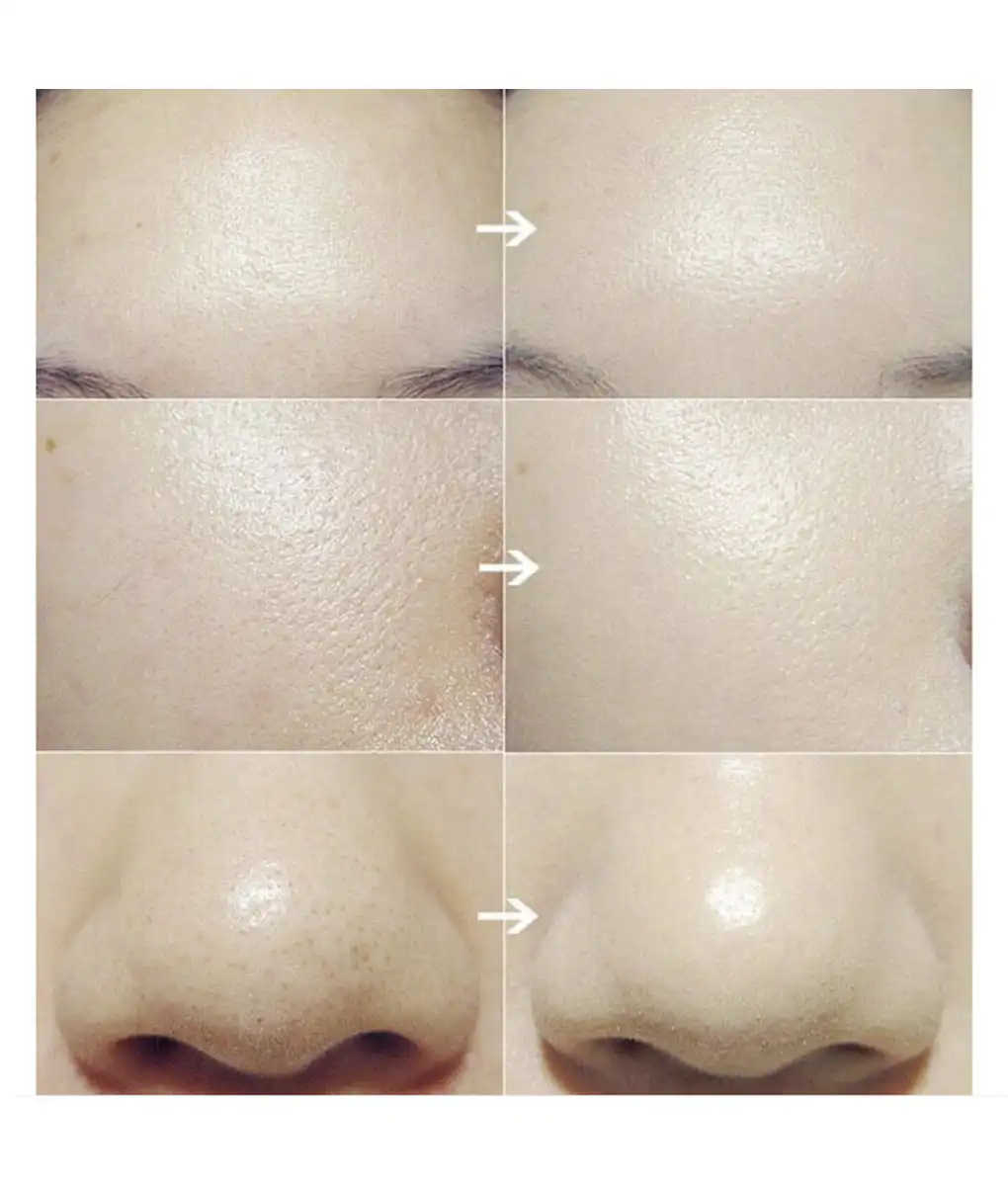 cleaning brush,universal brush,face brush,best facial cleansing brush,Facial Cleansing Brush