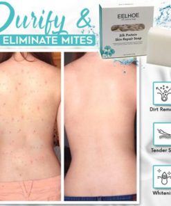 Skin Repair Soap,Skin Repair,Repair Soap,Silk-Protein