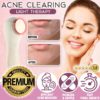 Acne Clearing Light Therapy