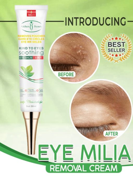 Milia רעמאָוואַל קרעם, Eye Milia Removal Cream, Eye Milia Removal, Eye Milia, Cream