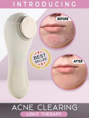 Acne Clearing Light Therapy,Acne Clearing,Light Therapy,Acne Clearing Light