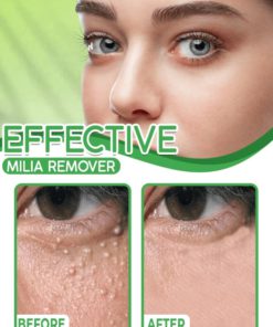 Milia Removal Cream,Eye Milia Removal Cream,Eye Milia Removal,Eye Milia,Cream