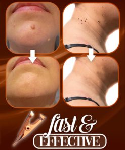 Tag Away Copper Clip Set,Copper Clip Set,Clip Set,Tag Away Copper