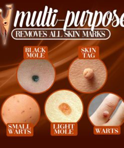 Tag Away Copper Clip Set,Copper Clip Set,Clip Set,Tag Away Copper