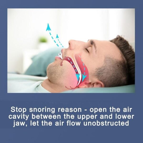 Antisnoring Silicone Braces Online Low Price MOLOOCO