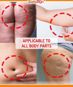 Cellulite Heating Spray,Cellulite Melting Spray,Heating Spray,Cellulite Heating,BurnUp!