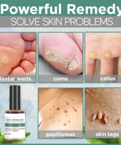 Corn Removal,Strengthen Gel,Extra Strengthen Gel,Extra Strengthen,Gel