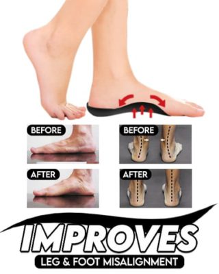 Orthopedic Insoles,Flat Foot Orthopedic,Foot Orthopedic,Flat Foot